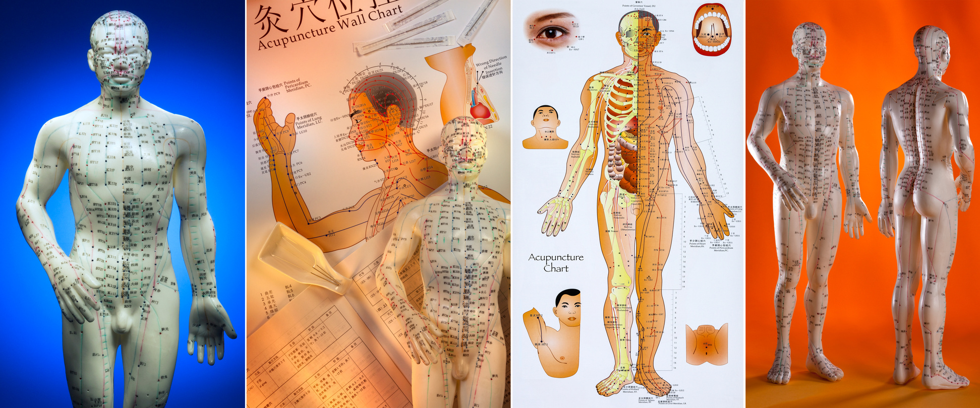 Acupuncture - Chinese Medicine